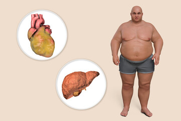 Wall Mural - Obese heart and liver in overweight man, 3D illustration. Concept of obesity and inner organs disease