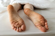© _KUBE_ - Person's legs sticking out under blanket. Male barefoot close-up with dry calluses and corns