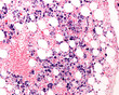 Macrophages labelled with Trypan blue