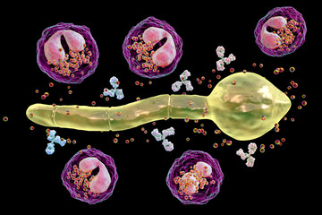 Wall Mural - Splendore-Hoeppli phenomenon, 3D illustration. Eosinophilic reaction around the invading fungal hyphae in human tissues