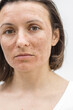 © Andrii - Cropped photo of woman with dry skin over white background.