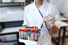 Doctor Hand Taking A Blood Sample Tube From A Rack With Machines Of Analysis In The Lab Background / Technician Holding Blood Tube Test In The Research Laboratory