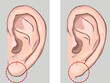 Free earlobe and attached earlobe in comparison. stock illustration