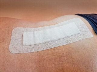 big plaster on men's back after spine operation - herniated discs surgery
