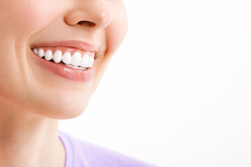 Wall Mural - Perfect white teeth smile of a young woman. The result of the teeth whitening procedure. The image symbolizes oral care dentistry, Closeup on a white background.