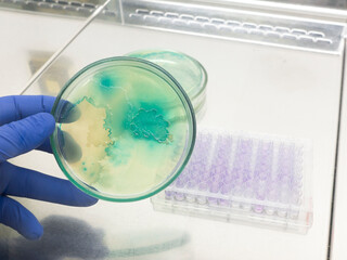 Sticker - Petri dish with green bacteria in the scientist's hand, close-up. Immunological studies on bacteria