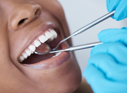 checkup, mouth and woman at the dentist for dental care, healthcare and search for cavities. mirror,