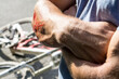 © Cavan Images - Injury