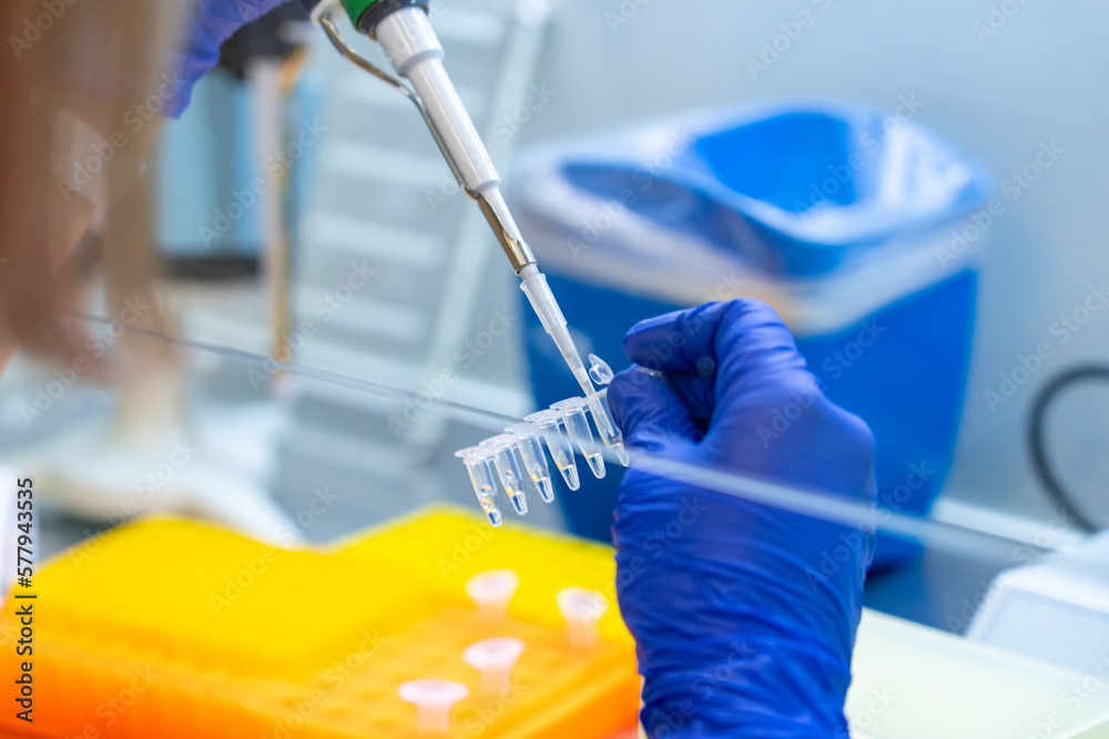 Scientist loads samples DNA amplification by PCR into plastic PCR strip ...