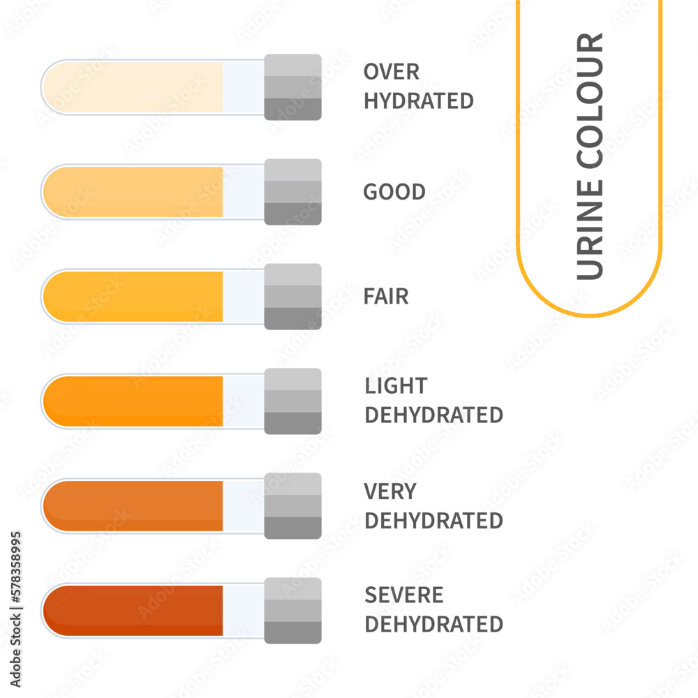 Vetor Urine colour chart. Hydration and dehydration level diagram ...