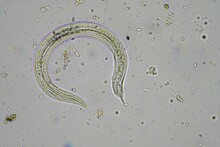 Soil Fungi, Microorganisms And Nematodes In A Soil And Compost Sample.