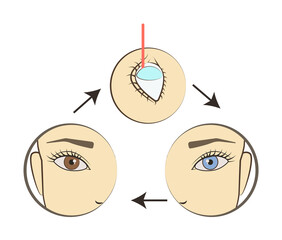 Poster - eye color change colored icon