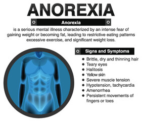 Wall Mural - Anorexia (Anorexia) and Its Effects on the Body