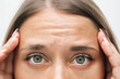 Young caucasian worried woman touching the forehead demonstrating wrinkles on her face on a white background. Wrinkling the forehead. Skin care. Beauty concept. Close up