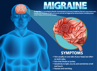 Canvas Print - Informative poster of Migraine