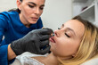 Young woman client get removing hair on the upper lip in face with hot sugar wax