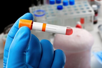 Poster - Doctor holding test tube with blood