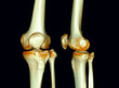 CT Scan of  Knee joint 3D rendering .