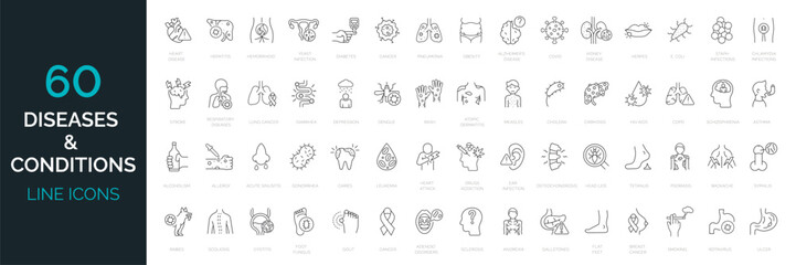 set of 60 line icons related to diseases, illness, condition. common diseases in the world. outline 