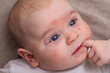 allergy red spots face the skin of a newborn baby baby