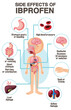 Human anatomy diagram cartoon style of ibuprofen side effects