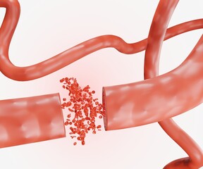 Wall Mural - bursting blood vessel and red blood cells scattered in the white background 3d rendering