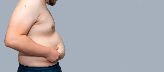 obese man holding his stomach