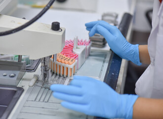 A pathologist is preparing a pathological biopsy for laboratory diagnosis of pathology.