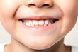 perfect kids smile, happy boy with beautiful white milk toothy smile, child dental care and stomatology, dentistry, generative ai.