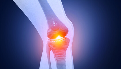 Pain in knee joint. Tendon problems and Joint inflammation on dark background. 3d illustration