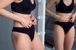 © Evgeniia - Woman in black underwear looking on her fat on her flabby belly in mirror. Skin care and weight loss concept. A young thin woman critically examines her figure in the mirror.