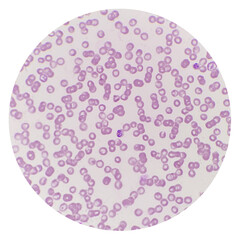 Wall Mural - Babesia parasites inside red blood cell, the causative agent of babesiosis. Babesia canis is a parasite that infects red blood cells and can lead to anemia.