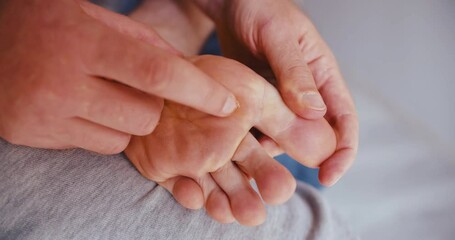 Canvas Print - Wart verrucas plantar, Fasciitis Wart on foot. Decease on foot skin. Close-up shot