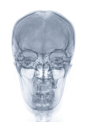 Poster - X-ray image of Human Skull   Front  view for diagnosis skull fracture  isolated on Black Background.