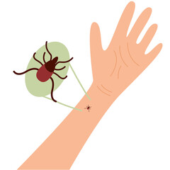 The human hand with  the tick bite. Tick bite hand.Tick bite.  Healthcare illustration. 