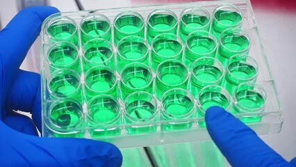 Canvas Print - Close-up, a gloved finger points to the wells with vaccine samples in the wells of an immunoassay plate.