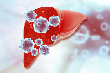 Hepatitis virus infection in human liver. 3d illustration..