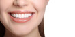 © SD Danver - Smiling woman with perfect teeth, close up. Dental clinic banner. Isolated on white background female perfect tooths. Generated AI mouth