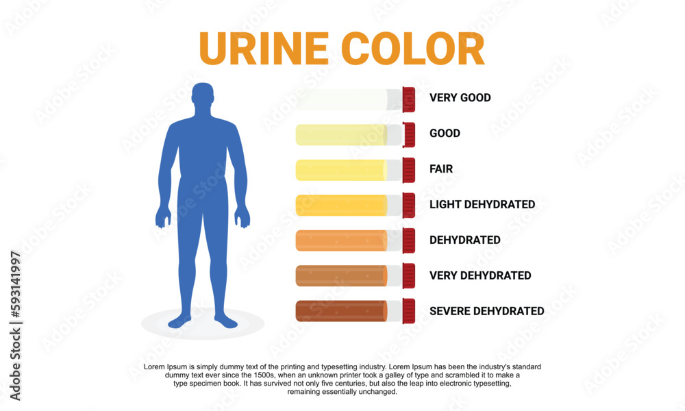 Illustration of urine color chart Stock Vector | Adobe Stock