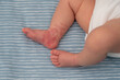 Hemangioma red birthmark on leg of newborn baby