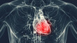 3d medical illustration of a man's inflamed heart