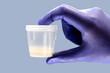 hand wearing nitrile glove holding semen or sperm sample collection container, semen donation concept