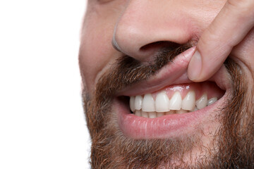 Poster - Man showing healthy gums on white background, closeup