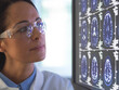 © Connect Images - Doctor analyzing brain scan for damage or disease