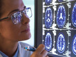 © Connect Images - Doctor analyzing brain scan for damage or disease