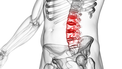 Poster - 3d medical illustration of lower back pain