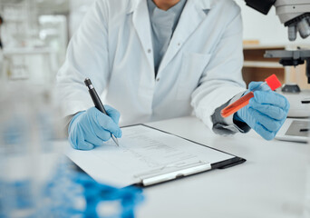 Poster - Keeping record of experiments matters. Shot of a scientist holding a sample while making notes.