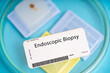 Endoscopic Biopsy