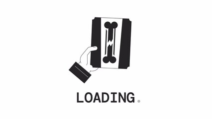 Fototapete - Trauma x ray bw loader animation. Radiography service. Bone scan. Flash message 4K video footage. Isolated monochrome loading progress indicator with alpha channel transparency for UI, UX web design