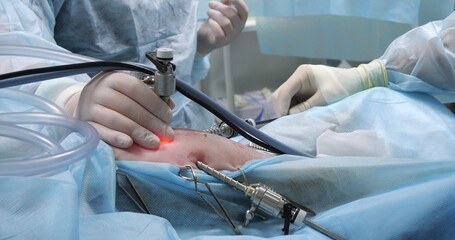 The veterinary operating team performs laparoscopic sterilization on a dog. The hands of a veterinary surgeon hold an endoscopic instrument. Close-up. The concept of laparoscopic Generative AI